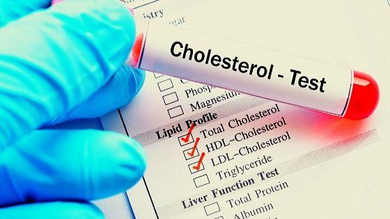 Низкий холестерин хорошо или плохо?